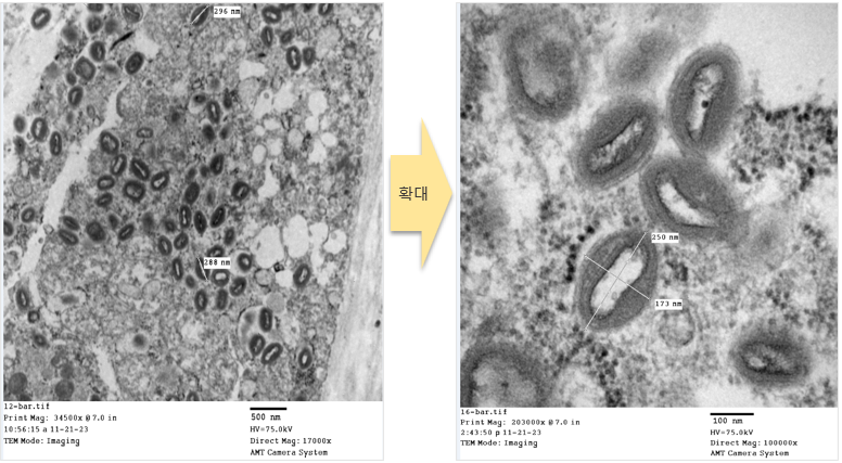 질병진단과에서 촬영한 LSD 바이러스입자